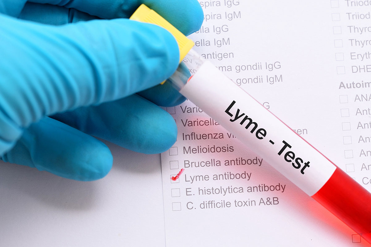 lyme test tube