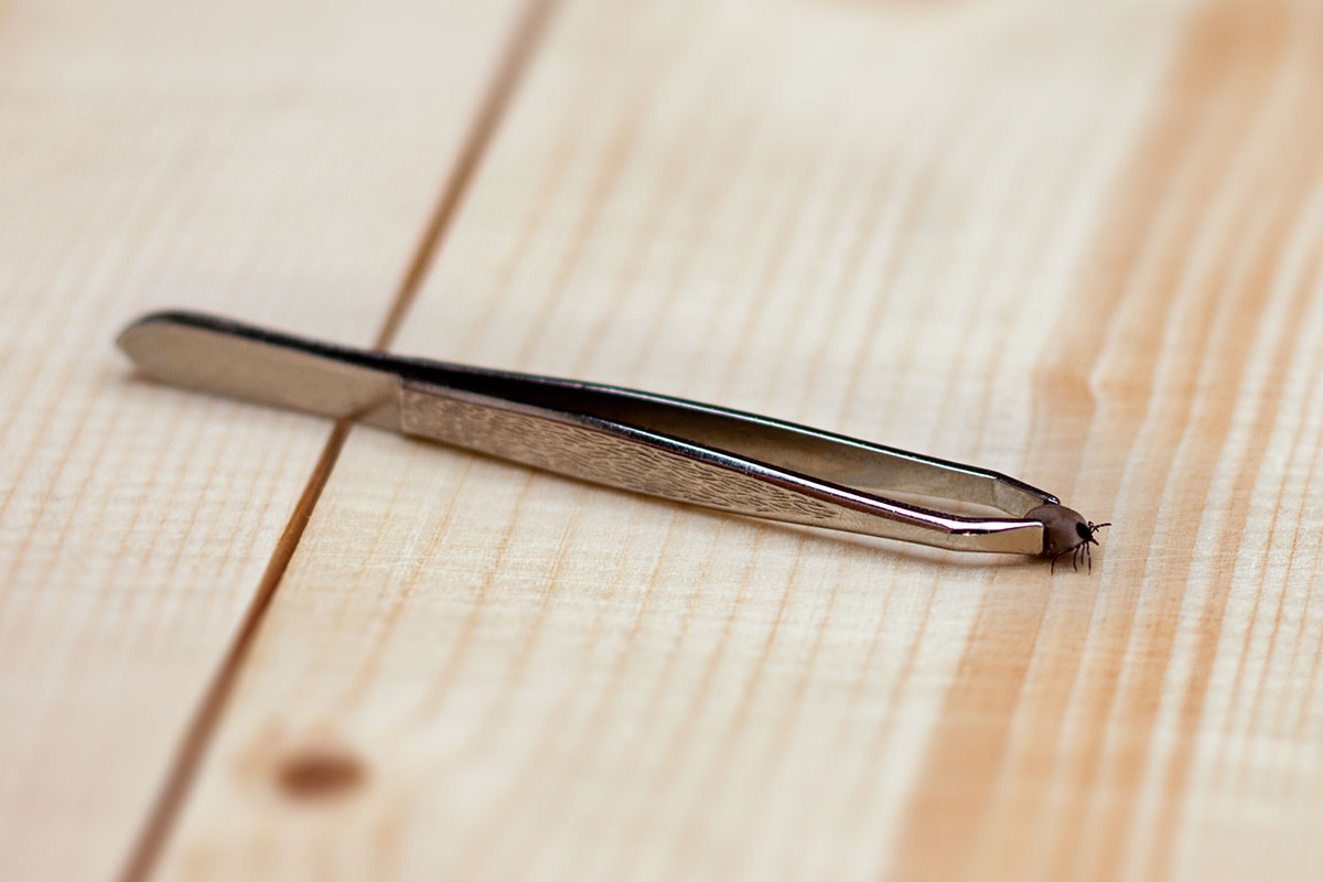 tweezers